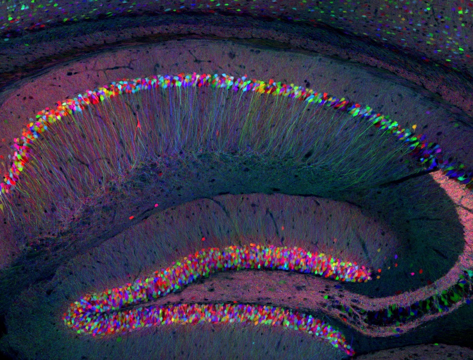 Brainbow