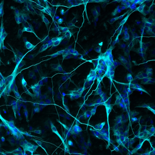 Human neuroblastoma SH-SY5Y cells