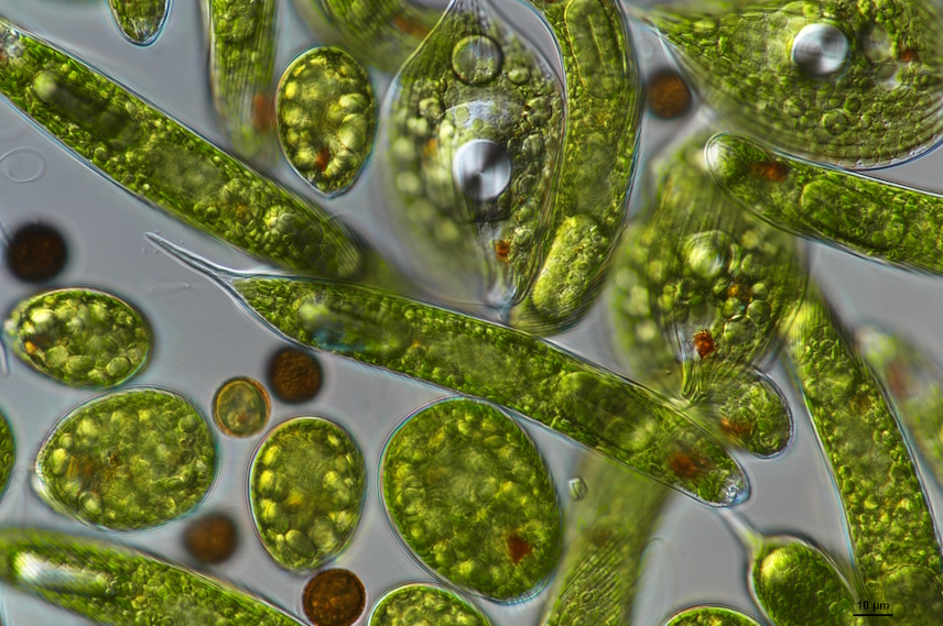 A collection of Euglena algae, showing the variety of shapes and sizes